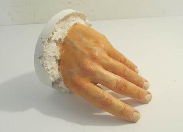 The cast hand